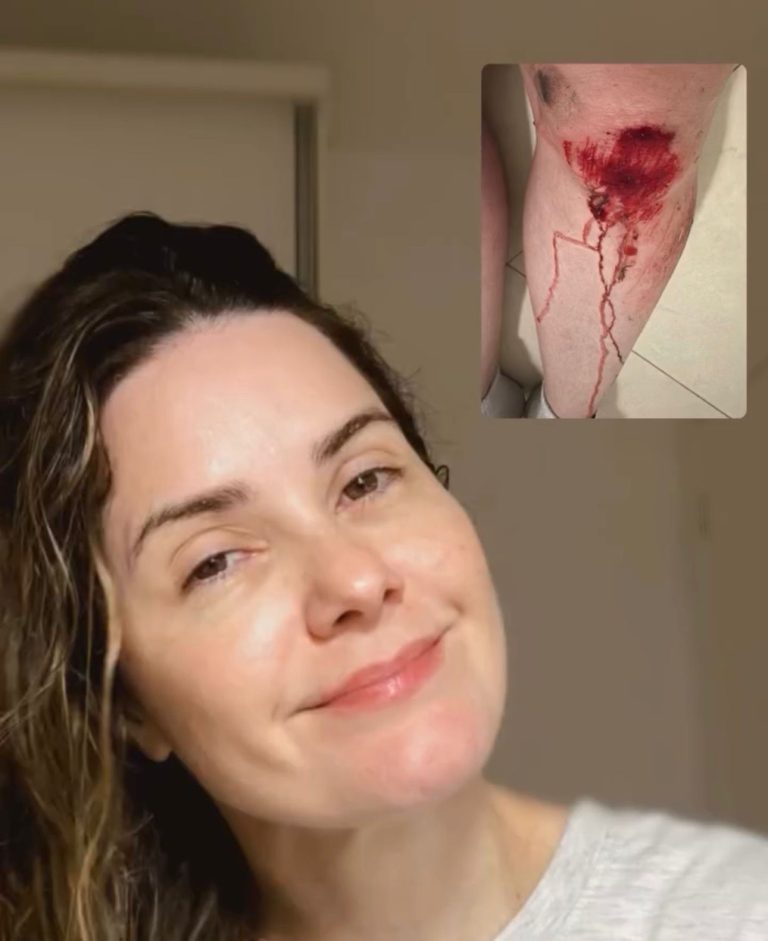 Repórter da Record Bahia é vítima de assalto em Ondina