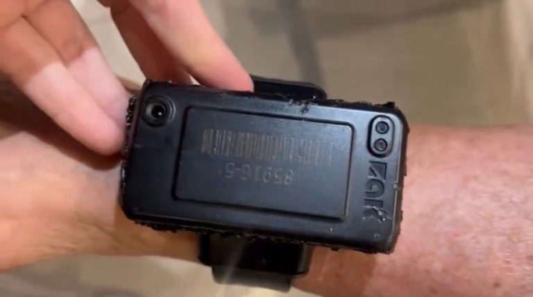 Tornozeleira de Bolsonaro apresenta sinais claros de tentativa de rompimento; veja vídeo