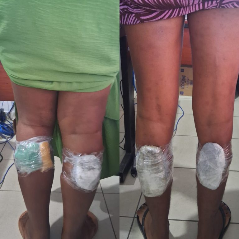 Mulheres são presas tentar entrar com drogas nas panturrilhas na Cadeia Pública de Salvador