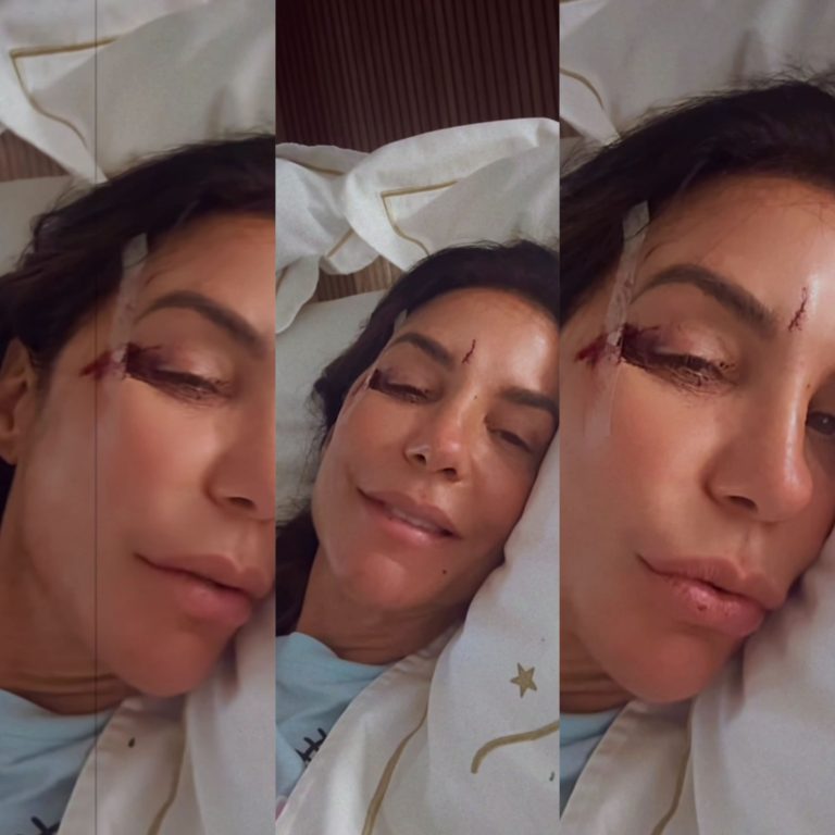 Ivete Sangalo é internada com ferimentos no rosto após desmaio e explica estado de saúde